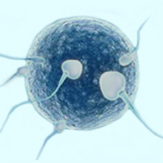 IVF/ Invitro Fertilization